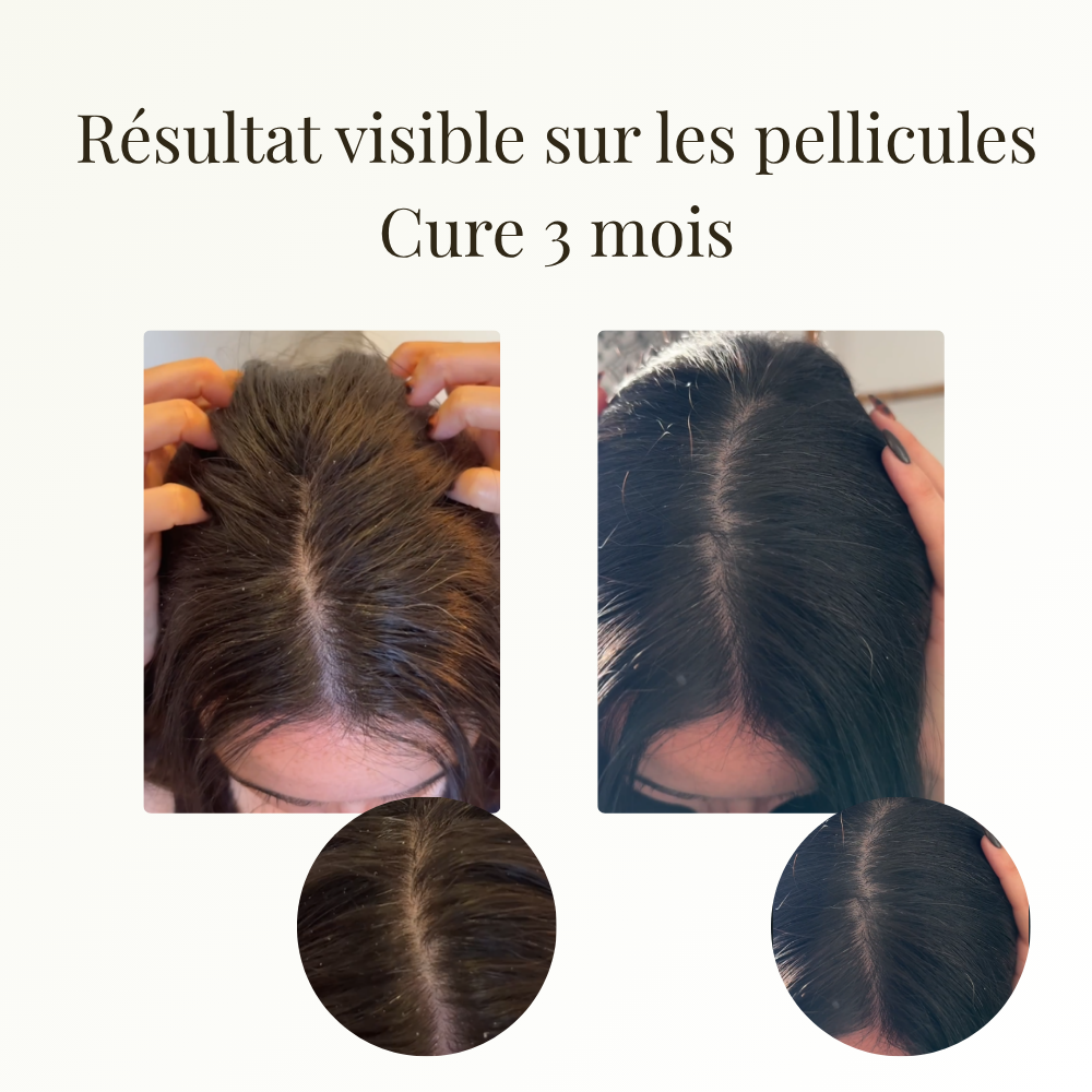 Sublime - Soin intense cuir chevelu 50ml