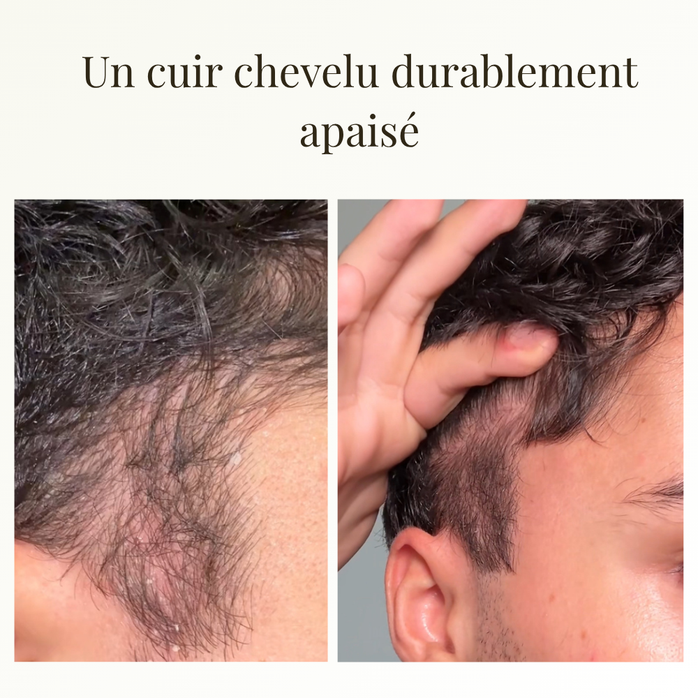 Sublime - Soin intense cuir chevelu 50ml