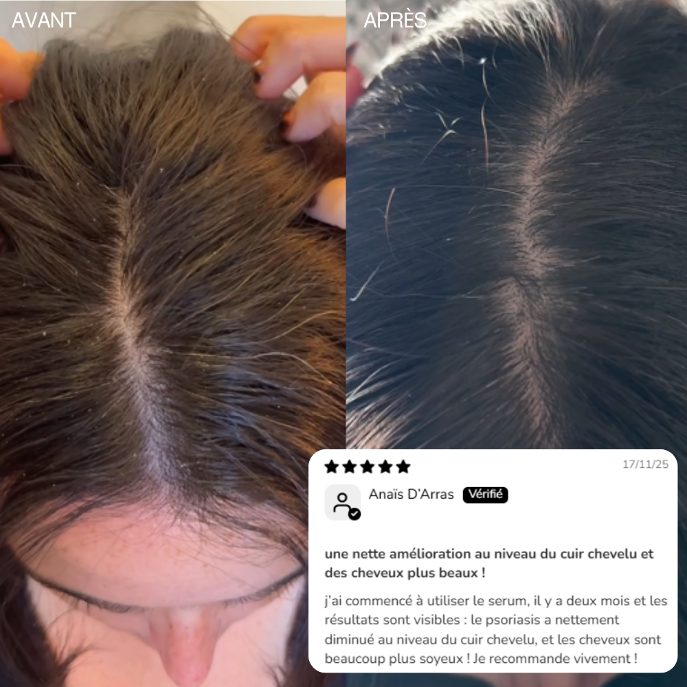 Sublime – Sérum cuir chevelu