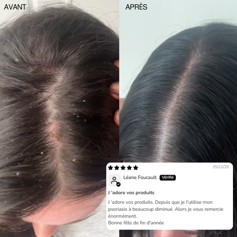 Sublime – Sérum cuir chevelu